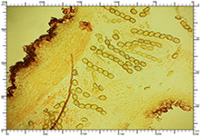 Genea hispidula